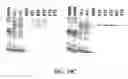 Fig. 14 - Composition and Method for Treatment and Prevention of Restenosis