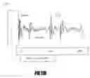 Fig. 15 - Apparatus and methods for acoustic diagnosis
