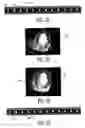 Fig. 08 - Ultrasonic imaging system and method for simulataneous display of blood flow and perfusion parameters