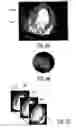Fig. 10 - Ultrasonic imaging system and method for simulataneous display of blood flow and perfusion parameters