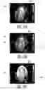 Fig. 14 - Ultrasonic imaging system and method for simulataneous display of blood flow and perfusion parameters