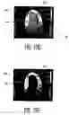 Fig. 15 - Ultrasonic imaging system and method for simulataneous display of blood flow and perfusion parameters