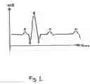 Fig. 02 - Heart beat signal analysis