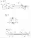 Fig. 02 - Systems and methods for creating cavities in interior body regions by propagation of energy
