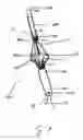Fig. 02 - Endograft