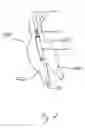 Fig. 03 - Endograft