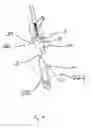 Fig. 05 - Endograft
