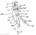 Fig. 09 - Endograft
