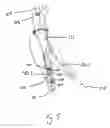 Fig. 10 - Endograft