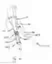 Fig. 13 - Endograft