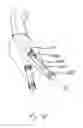 Fig. 16 - Endograft