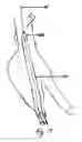 Fig. 18 - Endograft