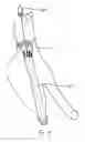 Fig. 19 - Endograft