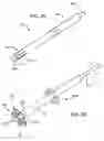 Fig. 04 - Devices and methods for use in performing transmyocardial coronary bypass