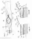 Fig. 08 - Devices and methods for use in performing transmyocardial coronary bypass