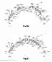 Fig. 06 - Stent with pockets for containing a therapeutic agent