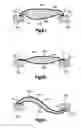 Fig. 14 - Stent with pockets for containing a therapeutic agent