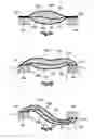 Fig. 16 - Stent with pockets for containing a therapeutic agent