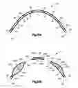 Fig. 17 - Stent with pockets for containing a therapeutic agent