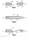 Fig. 21 - Stent with pockets for containing a therapeutic agent