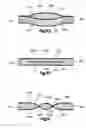 Fig. 23 - Stent with pockets for containing a therapeutic agent
