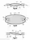 Fig. 25 - Stent with pockets for containing a therapeutic agent