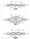 Fig. 26 - Stent with pockets for containing a therapeutic agent