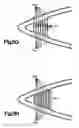 Fig. 14 - Stent with web-inducing nodes for increased surface area