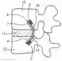 Fig. 01 - Methods and apparatus for reconstructing the annulus fibrosis