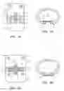 Fig. 03 - Methods and apparatus for reconstructing the annulus fibrosis