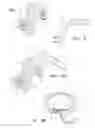 Fig. 05 - Methods and apparatus for reconstructing the annulus fibrosis