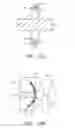 Fig. 07 - Methods and apparatus for reconstructing the annulus fibrosis