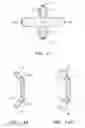Fig. 08 - Methods and apparatus for reconstructing the annulus fibrosis