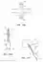 Fig. 10 - Methods and apparatus for reconstructing the annulus fibrosis