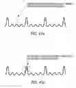 Fig. 45 - Methods and devices for relieving stress
