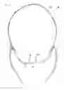 Fig. 02 - Holder for nasal cannula