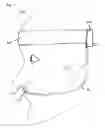 Fig. 05 - Holder for nasal cannula
