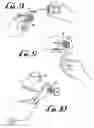 Fig. 04 - Compact fire sprinkler attachment insert