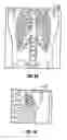 Fig. 09 - Apparatus and process for dose-guided radiotherapy