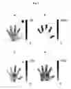 Fig. 03 - Optical imaging of rheumatoid arthritis