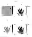 Fig. 04 - Optical imaging of rheumatoid arthritis