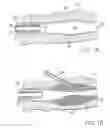 Fig. 02 - Tissue treatment