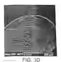 Fig. 07 - Tissue treatment