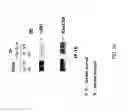 Fig. 35 - RNA expression profile predicting response to tamoxifen in breast cancer patients
