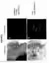 Fig. 06 - Modified colony assay