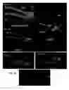 Fig. 04 - Upstream control elements of the proopiomelanocortin gene and their use
