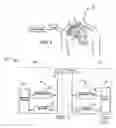 Fig. 02 - System and method for unscheduled wireless communication with a medical device
