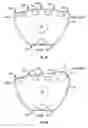 Fig. 03 - Exercise device