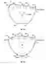 Fig. 04 - Exercise device
