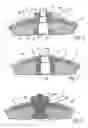 Fig. 02 - Implant with a skin penetration section